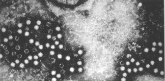 Prvi slučaj zaraze čovjeka virusom hepatitisa E izdvojenog iz štakora hepatitis E, zaraza