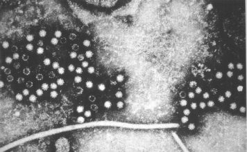 Prvi slučaj zaraze čovjeka virusom hepatitisa E izdvojenog iz štakora hepatitis E, zaraza