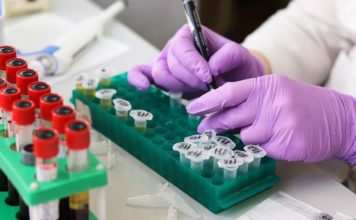 Znastvenici razvili test za desetominutno otkrivanje raka otkrivanje raka, istraživanje