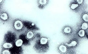 SARS i svinjska gripa – usporedba s koronavirusom SARS, svinjska gripa, koronavirus