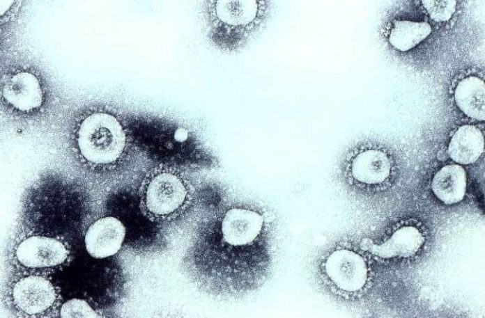 SARS, svinjska gripa, koronavirus